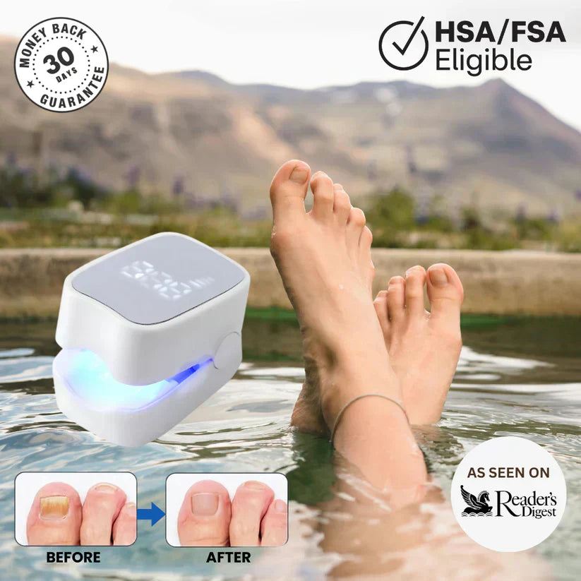 ClearNail Pro nail fungus laser device used at home for nail care with visible before and after results
