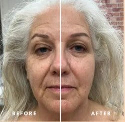 BrightSprout™ Lymphatic Face Brush